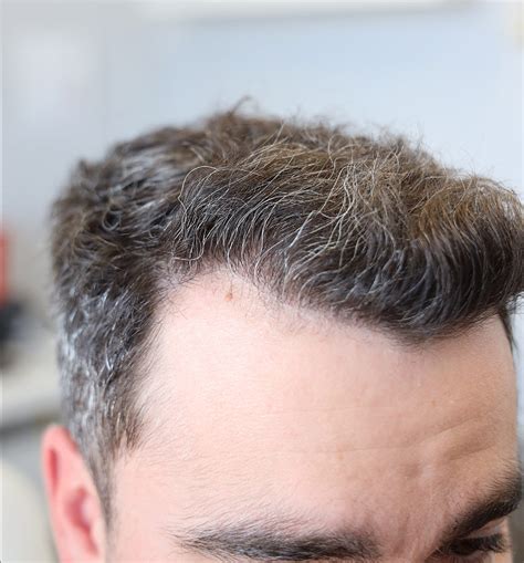 precision medical albuquerque|Precision Medical Hair .